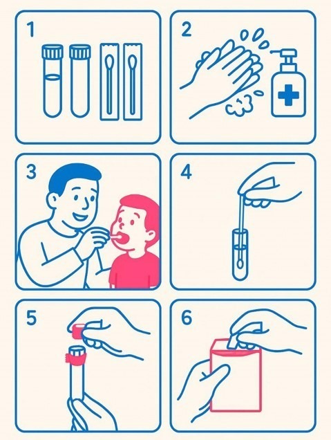 Exudado bucal